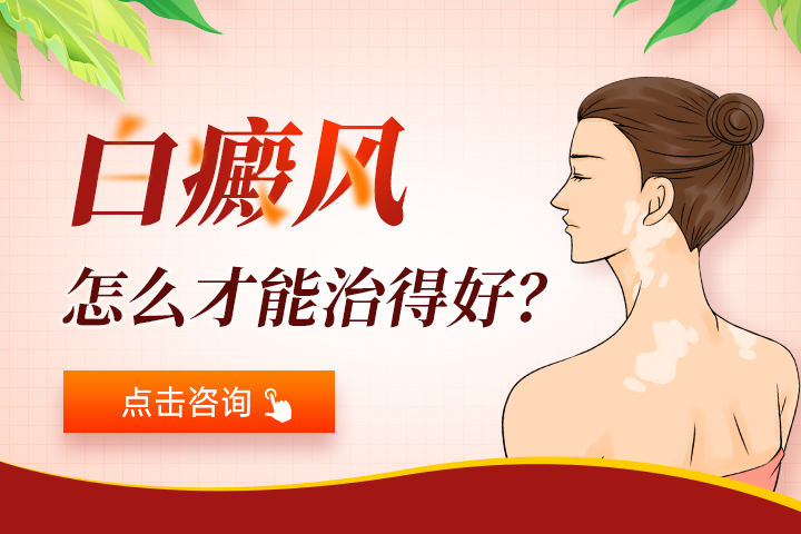 青岛治疗白癜风医院哪儿好